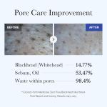 Medicube Zero Pore Blackhead Mud Facial Mask - Skin Cooling & Pore Tightening